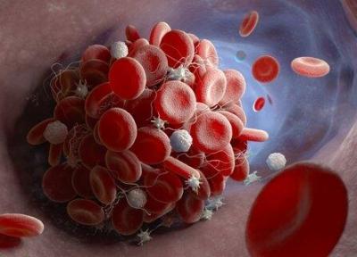 دانشمندان علت لخته شدن خون در بیماران کرونا را پیدا کردند