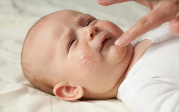 راهکارهای درمانی خشکی پوست کودک