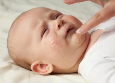 راهکارهای درمانی خشکی پوست کودک